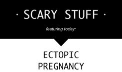 Ectopic Pregnancy